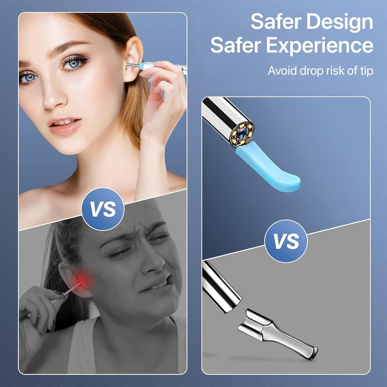 Smart Visual Ear Wax Cleaner - Buy Online fromDay2Dayy
