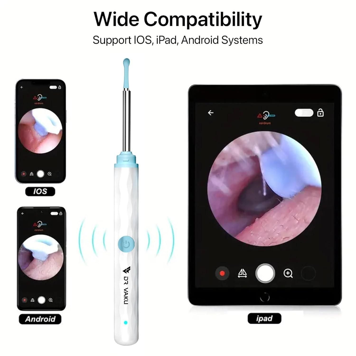 Smart Visual Ear Wax Cleaner - Buy Online fromDay2Dayy